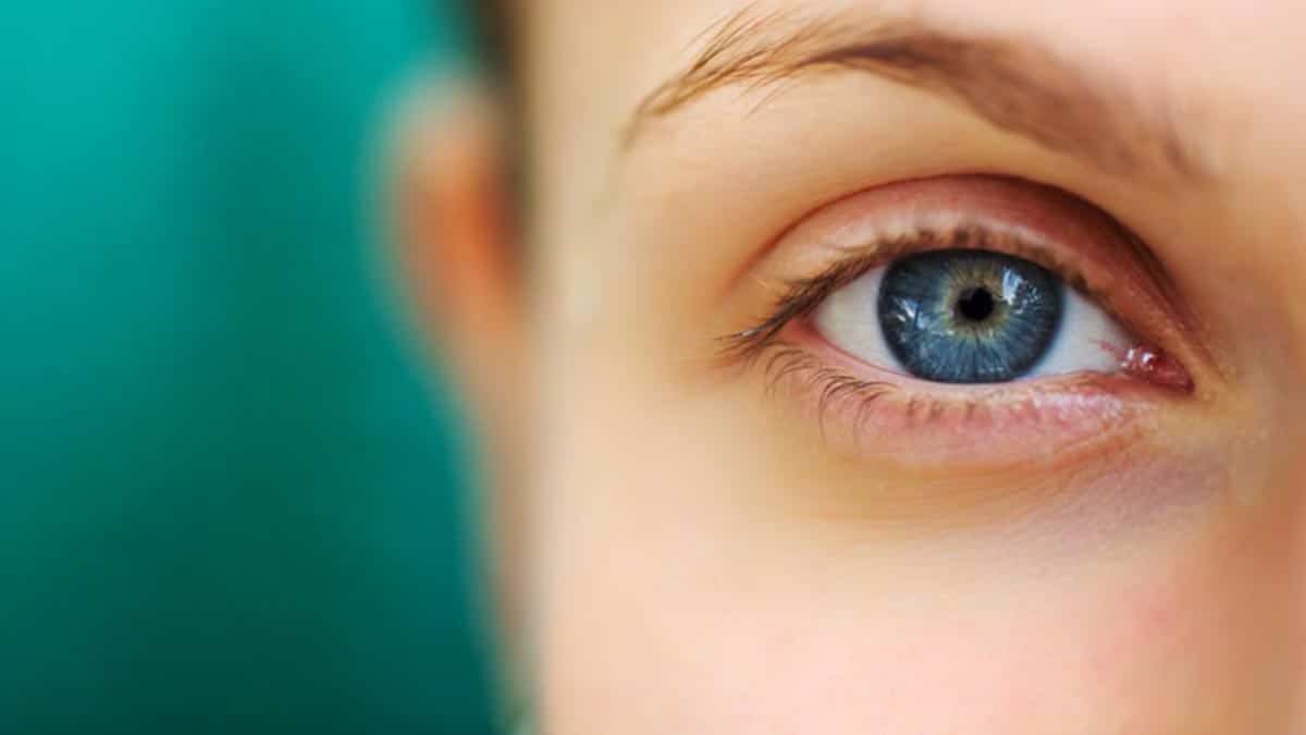Лечение заболеваний век. Здоровые глаза. Красивые Здоровые глаза. Обычные Здоровые глаза.